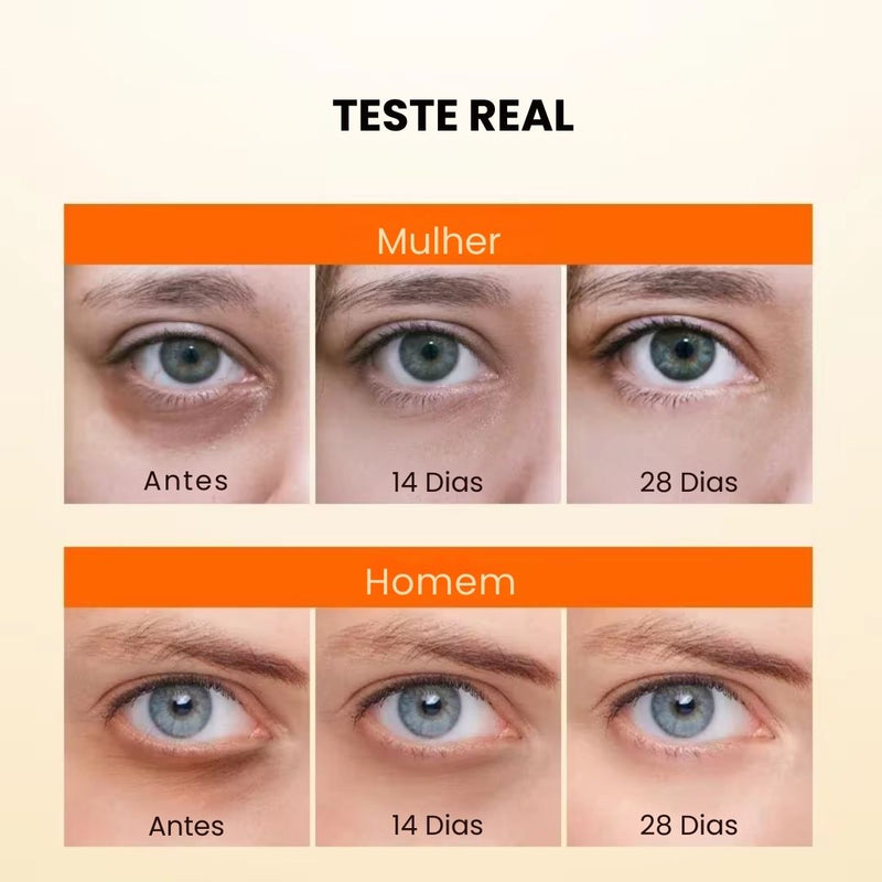 Creme Anti Olheiras e Rugas 20% De Vitamina C - Pele Clara e Rejuvenescida JoyPretty