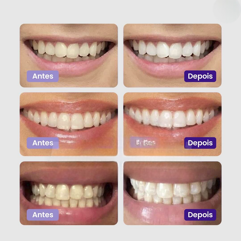 Clareador Dentário - Sérum V34™ + Brinde