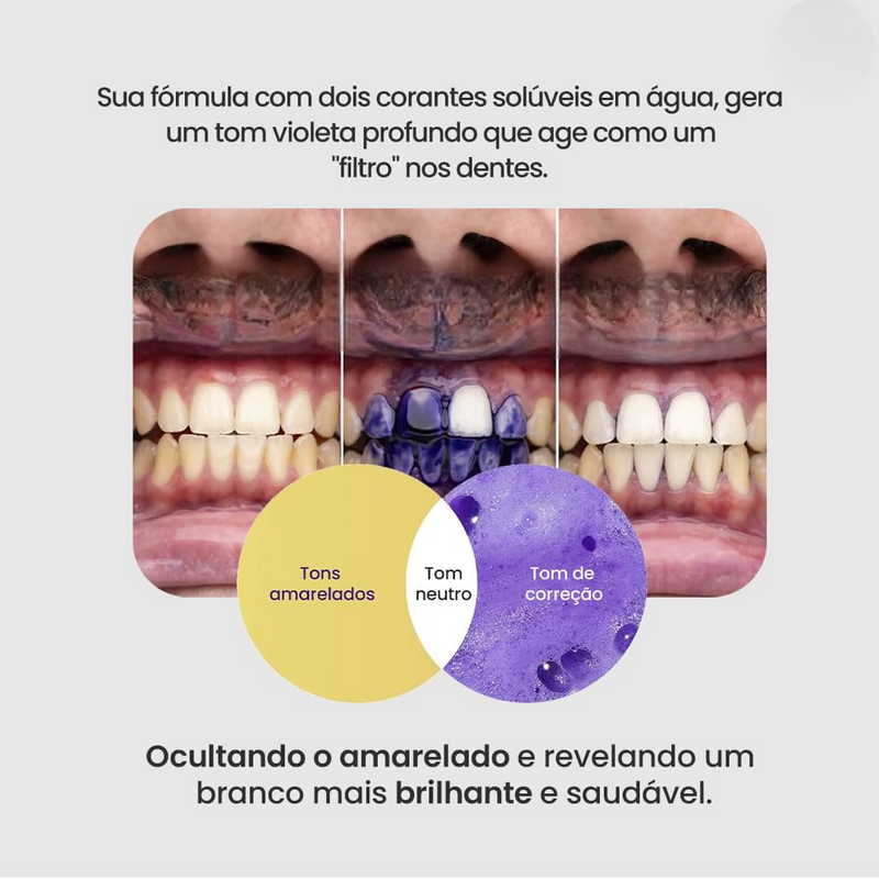 Clareador Dentário - Sérum V34™ + Brinde