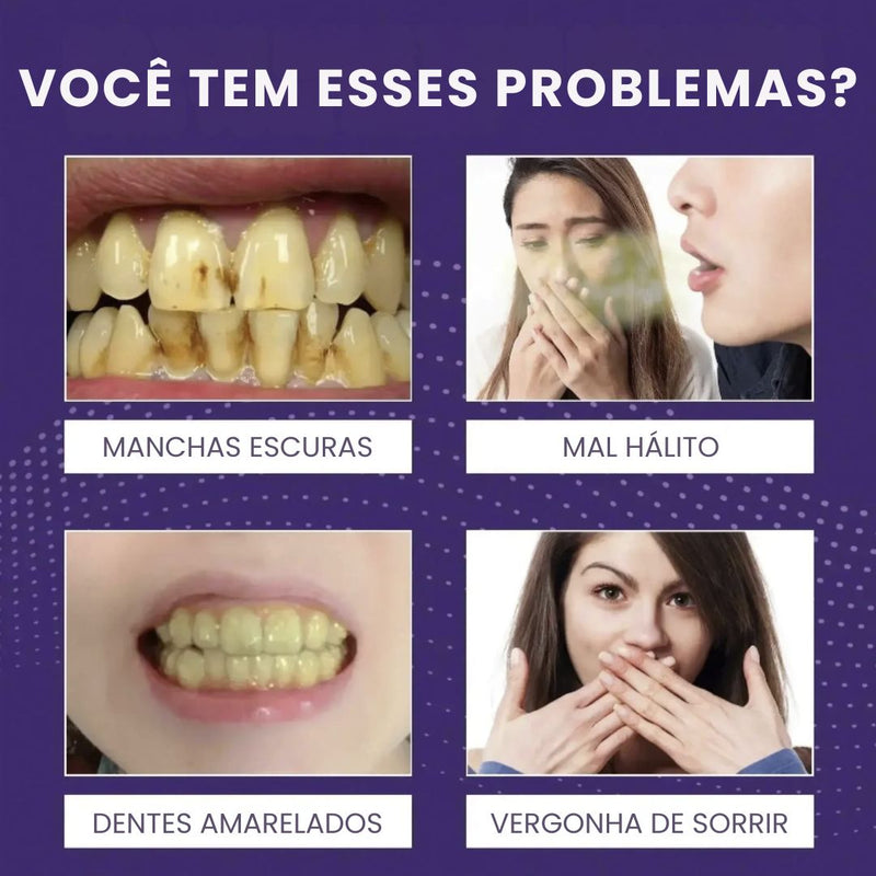 Clareador Dental Cream V34